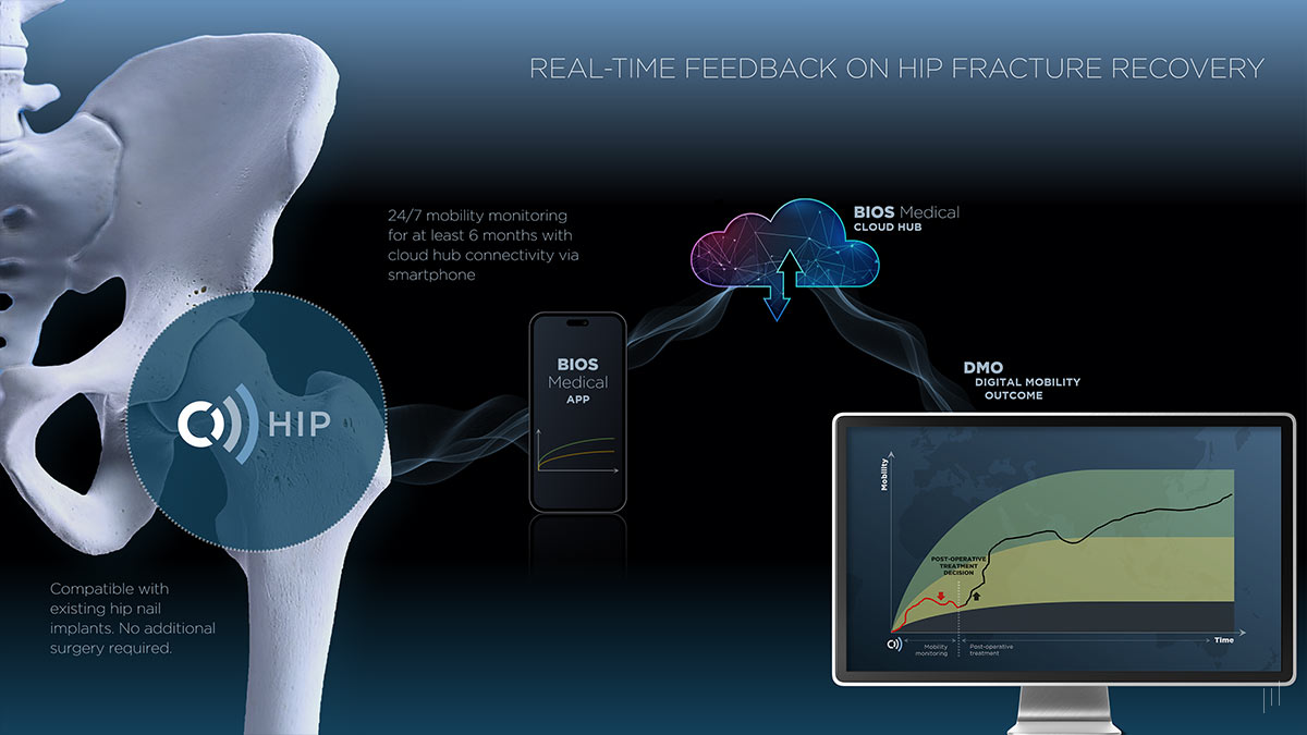 BIOS Biosensing Investor Presentation – Slide demonstrating how BIOS technology provides continuous recovery insights.